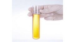 How Does A Photoinitiator Work?